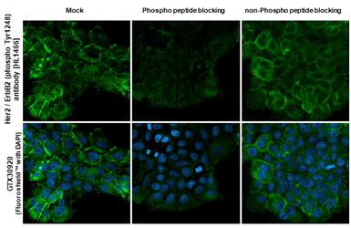 Anti-Her2 / ErbB2 (phospho Tyr1248) antibody [HL1466] used in Immunocytochemistry/ Immunofluorescence (ICC/IF). GTX636940